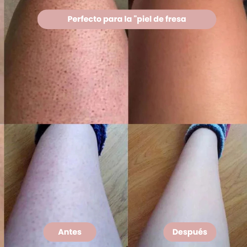PURELAX™ -¡Olvídate de los molestos puntos rojos!